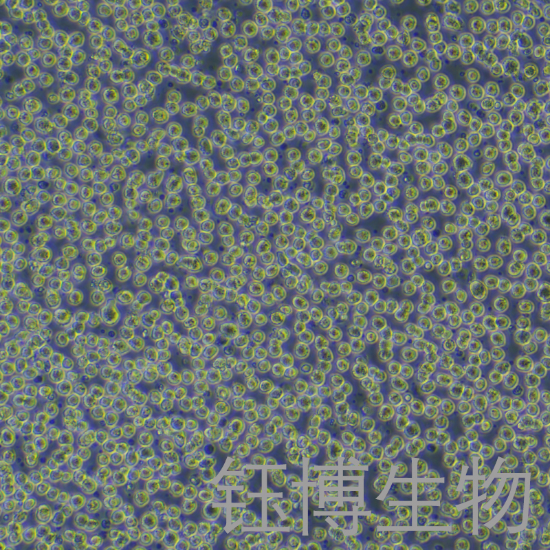 Karpas-299（人间变性大细胞淋巴瘤细胞）YB-71839HC