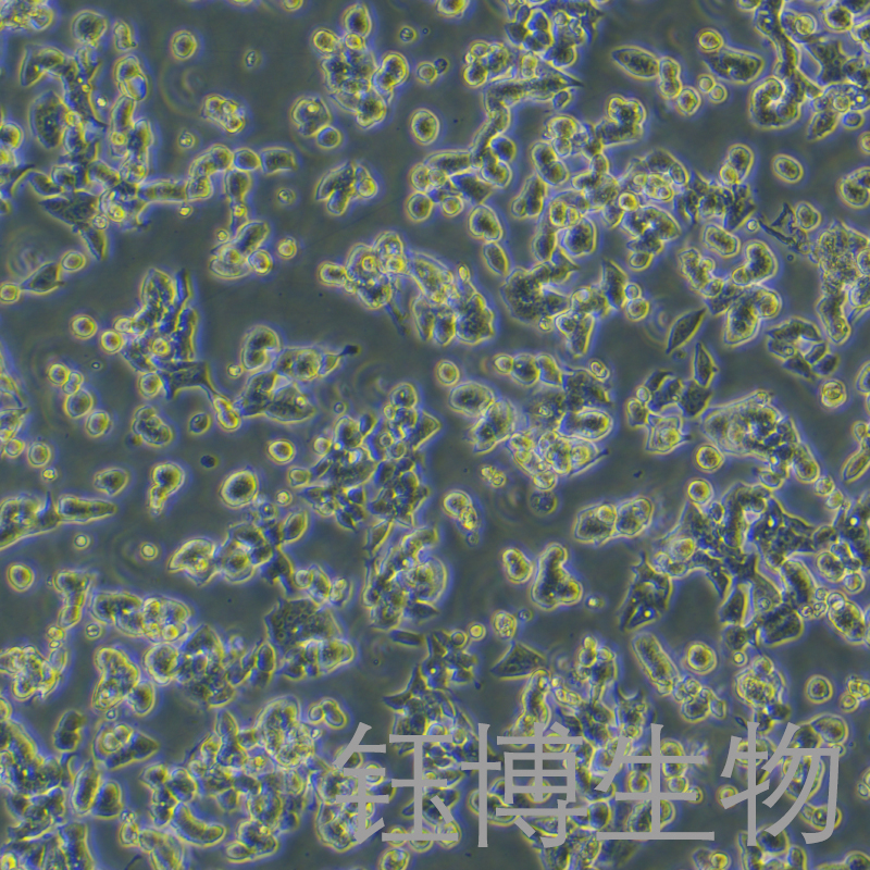 LS1034（人结肠腺癌细胞）YB-71842HC