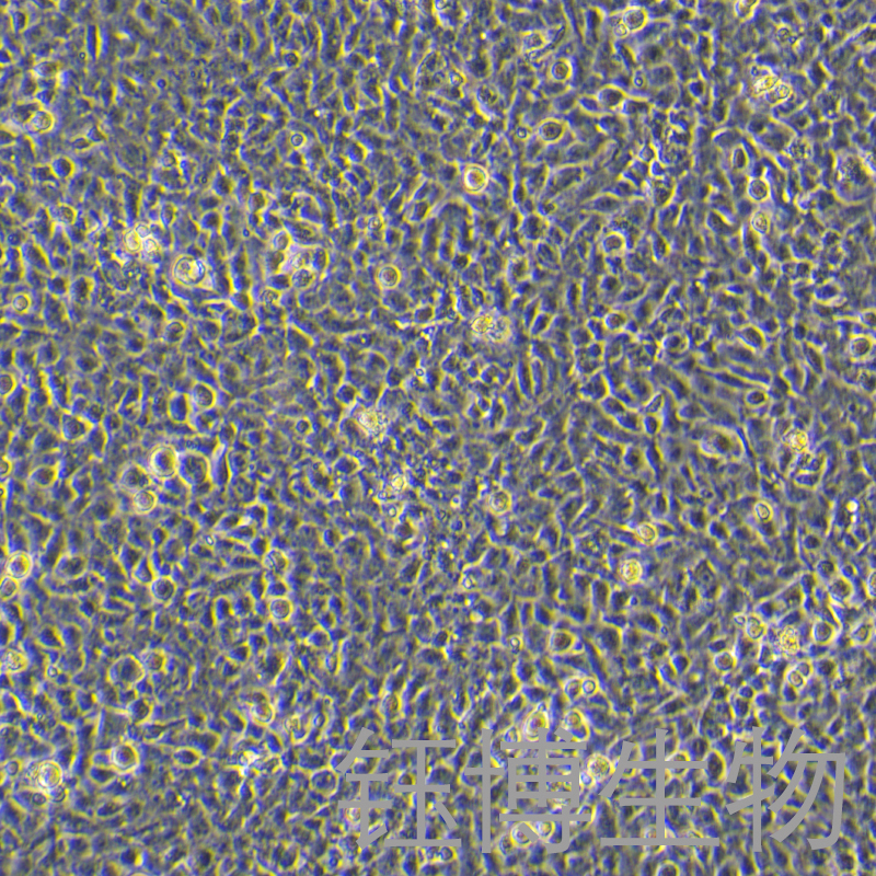HCMEC/D3（人永生化脑微血管内皮细胞）YB-71850HC