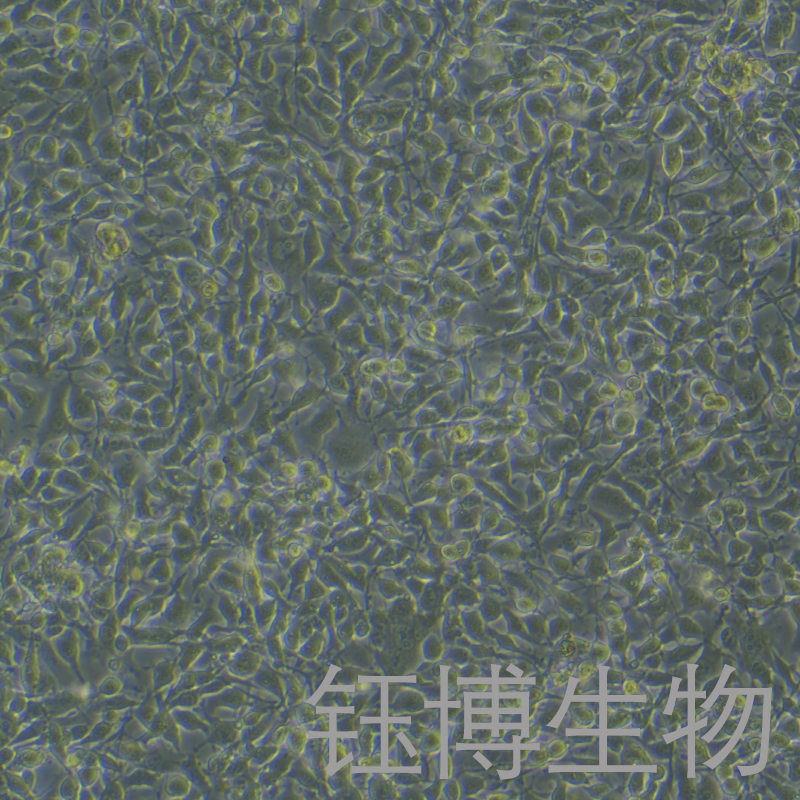 B16-F10+LUC（小鼠黑色素瘤细胞荧光素酶标记）YB-7049MC