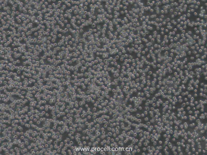 Mino细胞 (人外周血套细胞淋巴瘤细胞) (STR鉴定正确)CL-0779