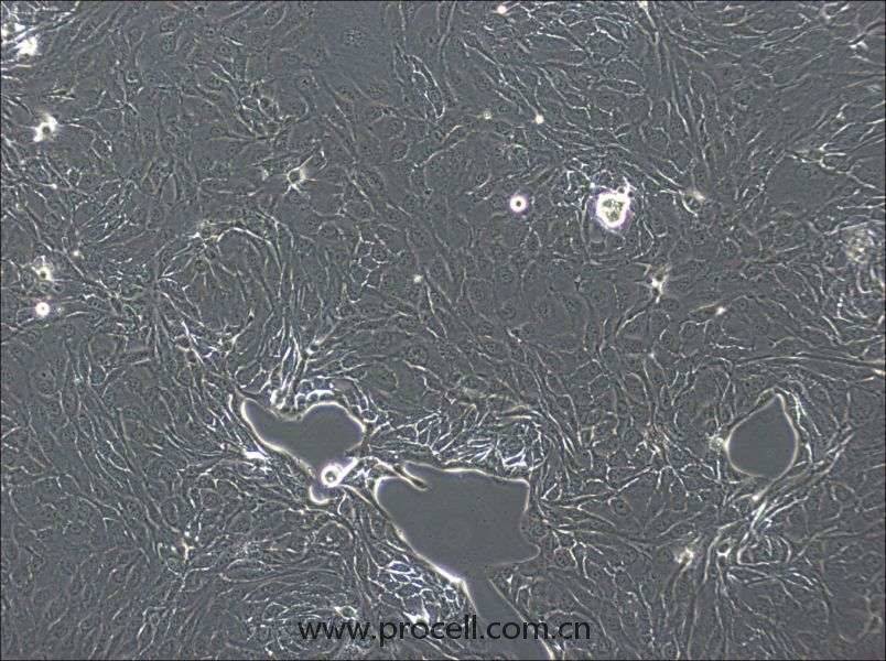 NCI-H2444细胞 (人非小细胞肺癌细胞) (STR鉴定正确)CL-0898