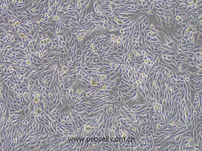 MP41细胞 (人眼葡萄膜黑色素瘤细胞) (STR鉴定正确)CL-0970