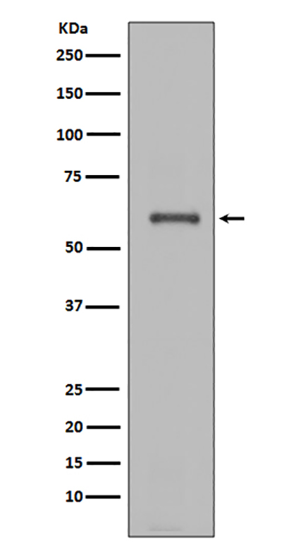 NOX4  (5T10) Rabbit Monoclonal Antibody | 兔单抗 | EnkiLife恩玑生命