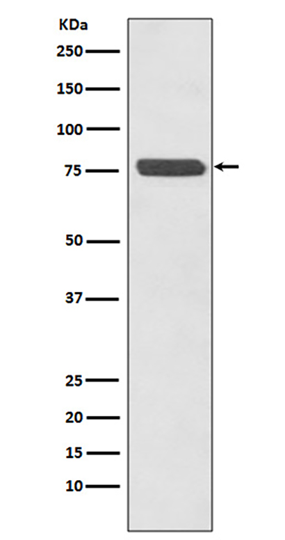 p63 (3J16) Rabbit Monoclonal Antibody | 兔单抗 | EnkiLife恩玑生命
