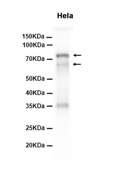 p73 (8W9) Rabbit Monoclonal Antibody | 兔单抗 | EnkiLife恩玑生命