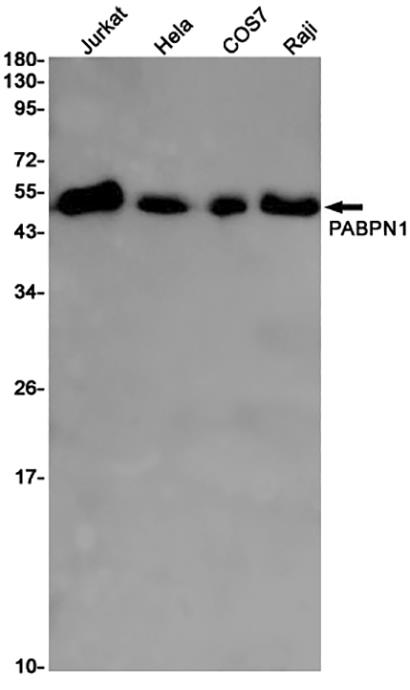 PABPN1 (9U19) Rabbit Monoclonal Antibody | 兔单抗 | EnkiLife恩玑生命
