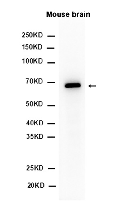 PAK3 (1O10) Rabbit Monoclonal Antibody | 兔单抗 | EnkiLife恩玑生命
