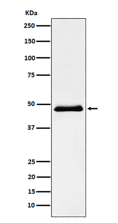 Pancreatic Lipase （PNLIP） (15J17) Rabbit Monoclonal Antibody | 兔单抗 | EnkiLife恩玑生命