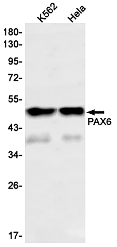 PAX6 (14C4) Rabbit Monoclonal Antibody | 兔单抗 | EnkiLife恩玑生命