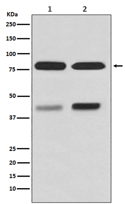 PKC beta 1 (9E18) Rabbit Monoclonal Antibody | 兔单抗 | EnkiLife恩玑生命