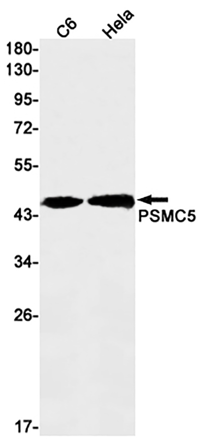 PSMC5 (17I3) Rabbit Monoclonal Antibody | 兔单抗 | EnkiLife恩玑生命