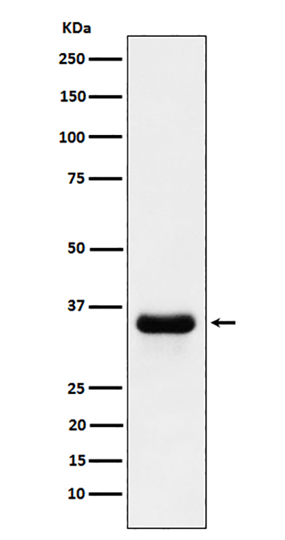 PSMD14 (10P7) Rabbit Monoclonal Antibody | 兔单抗 | EnkiLife恩玑生命