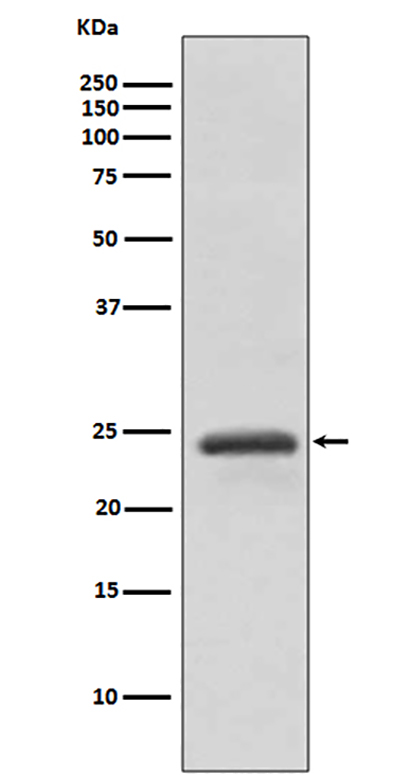 RAB11A (4O16) Rabbit Monoclonal Antibody | 兔单抗 | EnkiLife恩玑生命