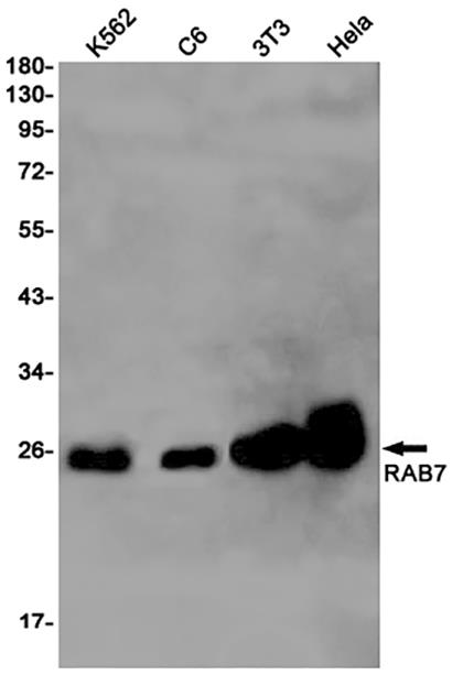 RAB7 (3N18) Rabbit Monoclonal Antibody | 兔单抗 | EnkiLife恩玑生命