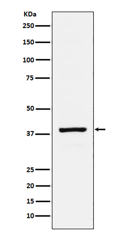 RASSF1 (19I9) Rabbit Monoclonal Antibody | 兔单抗 | EnkiLife恩玑生命