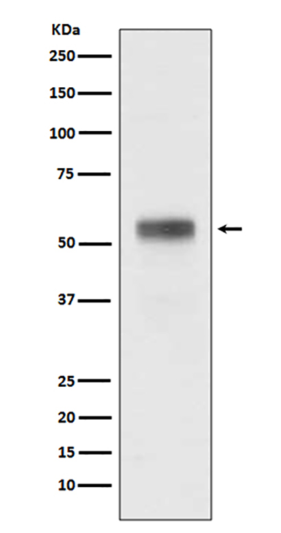Retinoic Acid Receptor alpha (12V14) Rabbit Monoclonal Antibody | 兔单抗 | EnkiLife恩玑生命