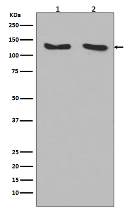 RNF20 (12E8) Rabbit Monoclonal Antibody | 兔单抗 | EnkiLife恩玑生命