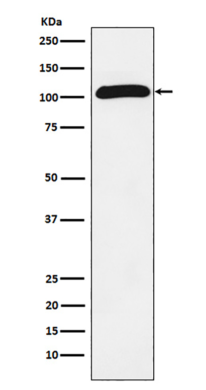 ROR2 (9T12) Rabbit Monoclonal Antibody | 兔单抗 | EnkiLife恩玑生命