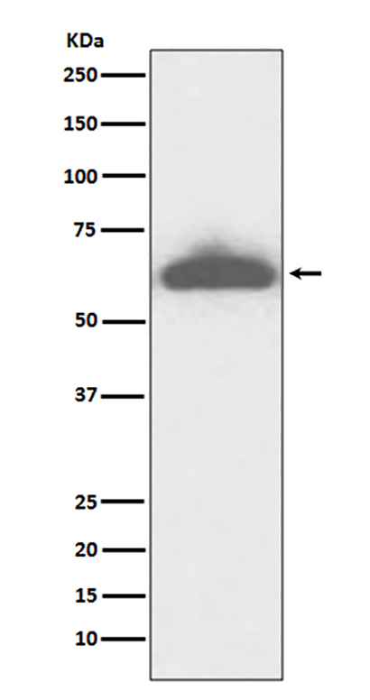 RPE65 (5T1) Rabbit Monoclonal Antibody | 兔单抗 | EnkiLife恩玑生命