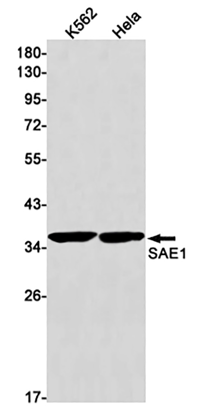 SAE1 (17L1) Rabbit Monoclonal Antibody | 兔单抗 | EnkiLife恩玑生命
