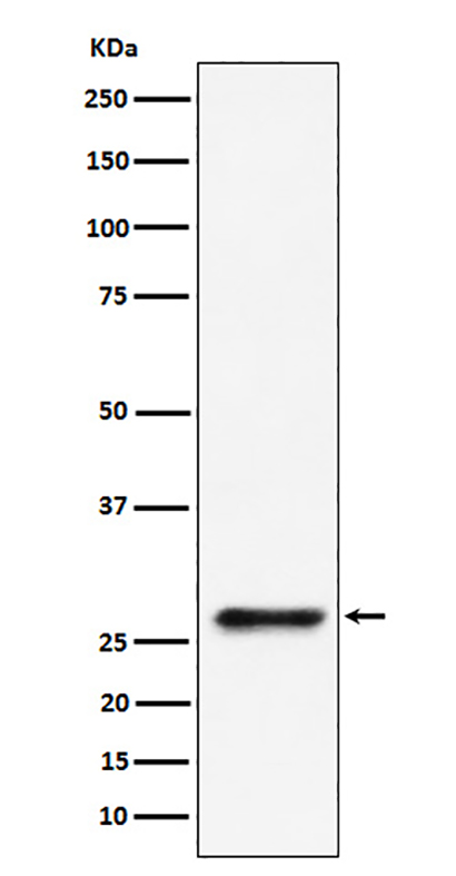 SBDS (5N11) Rabbit Monoclonal Antibody | 兔单抗 | EnkiLife恩玑生命