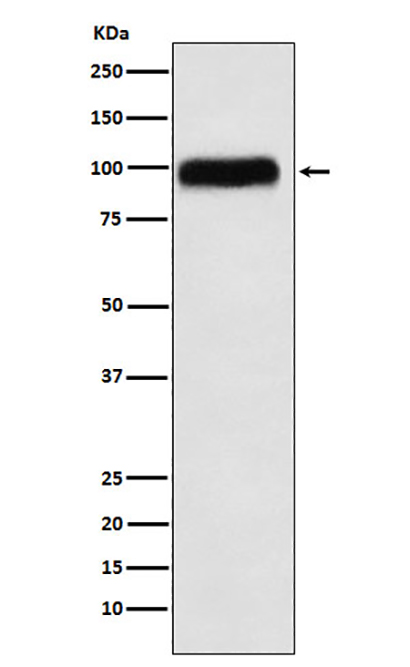 SERPING1 (12Y5) Rabbit Monoclonal Antibody | 兔单抗 | EnkiLife恩玑生命