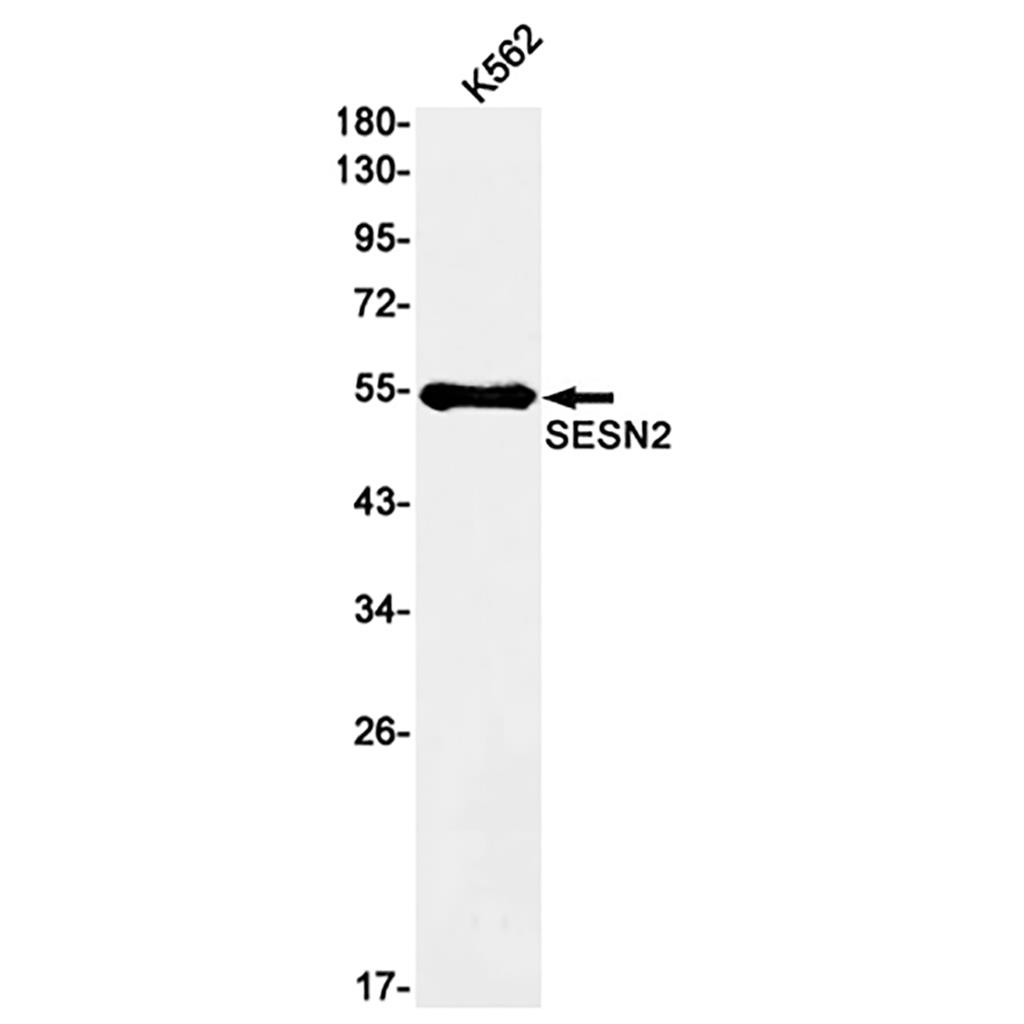SESN2 (9H4) Rabbit Monoclonal Antibody | 兔单抗 | EnkiLife恩玑生命