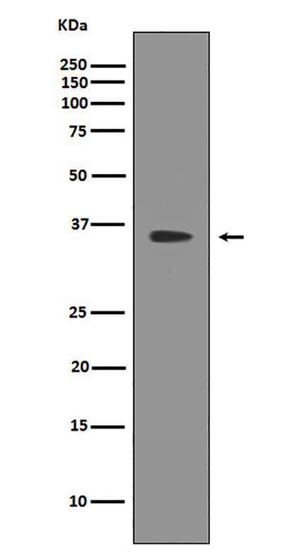 SIRT2  (7W12) Rabbit Monoclonal Antibody | 兔单抗 | EnkiLife恩玑生命