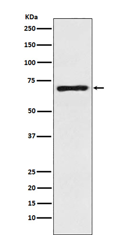 SLC6A1 / GAT1 (9T4) Rabbit Monoclonal Antibody | 兔单抗 | EnkiLife恩玑生命