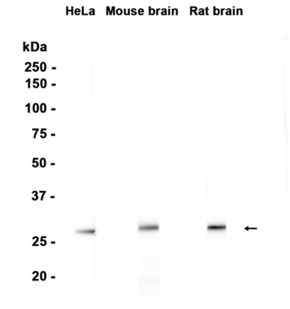 SNAP29 (10N2) Rabbit Monoclonal Antibody | 兔单抗 | EnkiLife恩玑生命