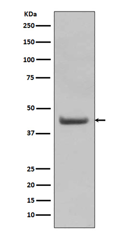 SOX18 (7L17) Rabbit Monoclonal Antibody | 兔单抗 | EnkiLife恩玑生命