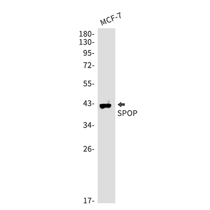 SPOP (2B14) Rabbit Monoclonal Antibody | 兔单抗 | EnkiLife恩玑生命