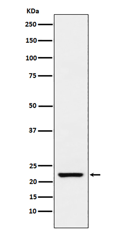 TAGLN (17E19) Rabbit Monoclonal Antibody | 兔单抗 | EnkiLife恩玑生命