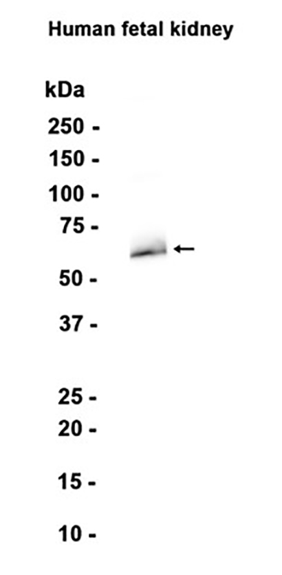 TGFBI (10L15) Rabbit Monoclonal Antibody | 兔单抗 | EnkiLife恩玑生命
