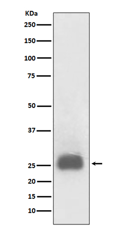 TIMP1 (1S3) Rabbit Monoclonal Antibody | 兔单抗 | EnkiLife恩玑生命