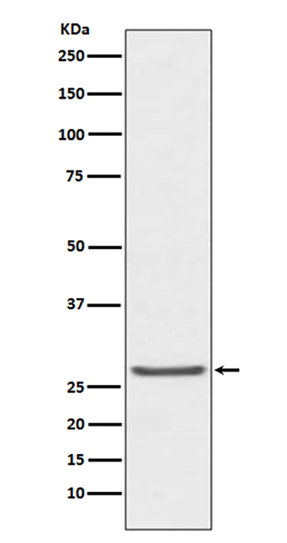 TIMP1 (9Y15) Rabbit Monoclonal Antibody | 兔单抗 | EnkiLife恩玑生命