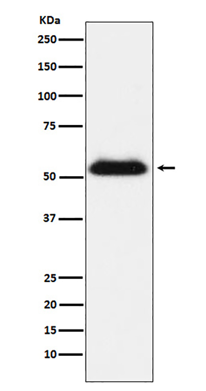 TMPRSS2 (6M19) Rabbit Monoclonal Antibody | 兔单抗 | EnkiLife恩玑生命