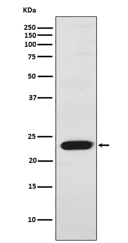 TNNI2 (3O11) Rabbit Monoclonal Antibody | 兔单抗 | EnkiLife恩玑生命