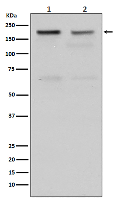 Topoisomerase II alpha (2J12) Rabbit Monoclonal Antibody | 兔单抗 | EnkiLife恩玑生命