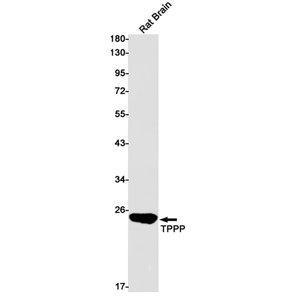 TPPP (5H10) Rabbit Monoclonal Antibody | 兔单抗 | EnkiLife恩玑生命