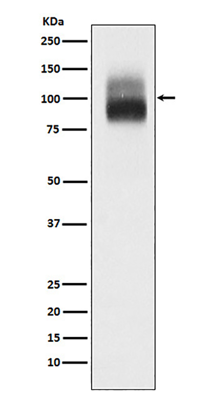 TrkB (3K17) Rabbit Monoclonal Antibody | 兔单抗 | EnkiLife恩玑生命