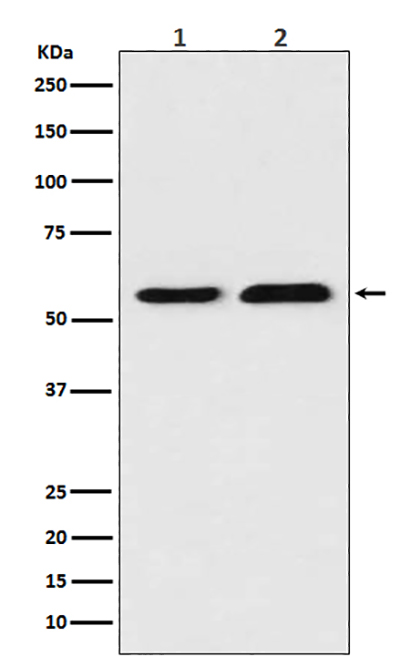 TXNRD1 (6I18) Rabbit Monoclonal Antibody | 兔单抗 | EnkiLife恩玑生命