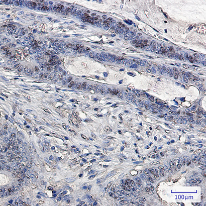 Ubiquitin (10Y8) Rabbit Monoclonal Antibody | 兔单抗 | EnkiLife恩玑生命