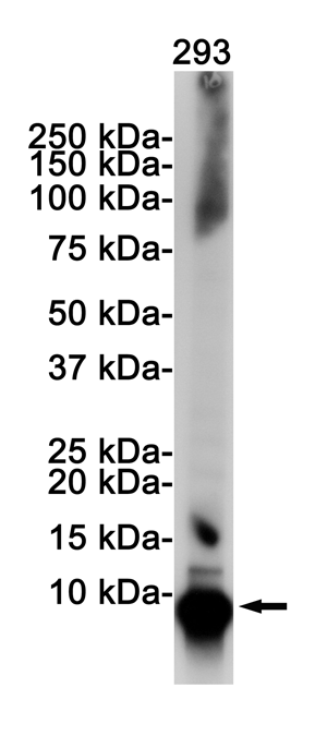 Ubiquitin (10Y8) Rabbit Monoclonal Antibody | 兔单抗 | EnkiLife恩玑生命