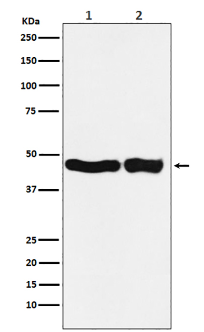 UQCRC2  (11W16) Rabbit Monoclonal Antibody | 兔单抗 | EnkiLife恩玑生命