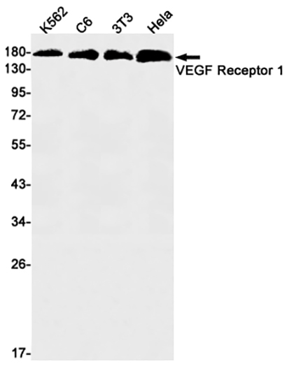 VEGF Receptor 1 (16I17) Rabbit Monoclonal Antibody | 兔单抗 | EnkiLife恩玑生命