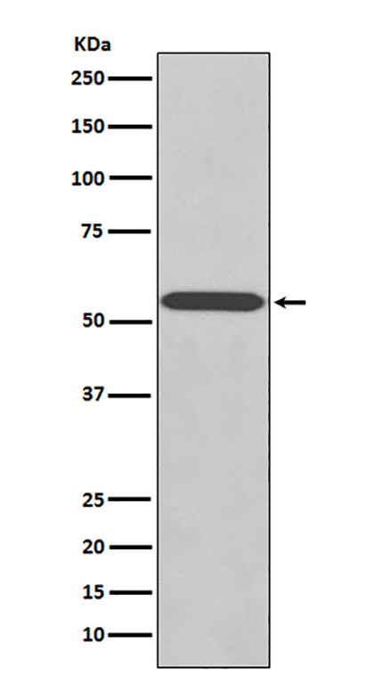 Wilms Tumor Protein (13C17) Rabbit Monoclonal Antibody | 兔单抗 | EnkiLife恩玑生命