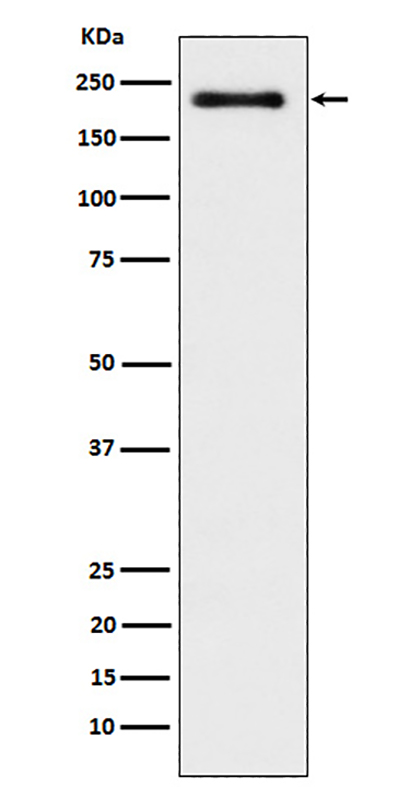 WRN (5Y12) Rabbit Monoclonal Antibody | 兔单抗 | EnkiLife恩玑生命