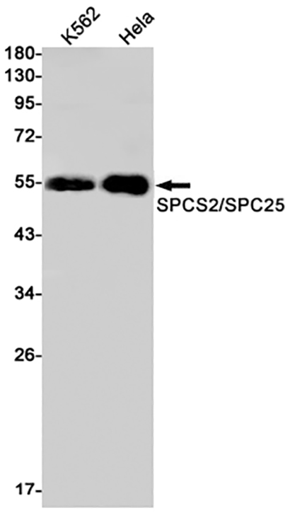 WTAP (4C15) Rabbit Monoclonal Antibody | 兔单抗 | EnkiLife恩玑生命